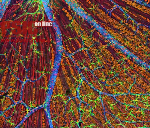 cellule microglia